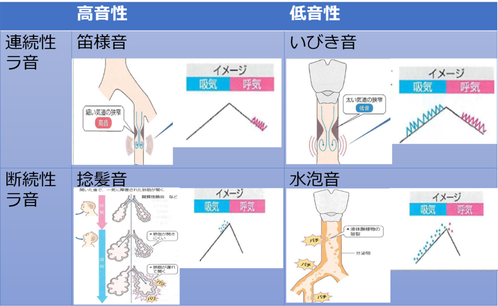 呼吸音（肺音）と聴診 My Reha Note
